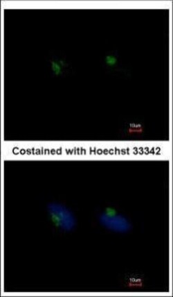 Invitrogen RGS11 Polyclonal Antibody 100 &mu;L; Unconjugated:Antibodies,