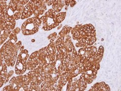 Invitrogen RGS11 Polyclonal Antibody 100 &mu;L; Unconjugated:Antibodies,