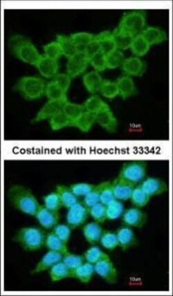 Invitrogen FRAT1 Polyclonal Antibody 100 &mu;L; Unconjugated:Antibodies,