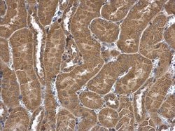 Invitrogen FRAT1 Polyclonal Antibody 100 &mu;L; Unconjugated:Antibodies,