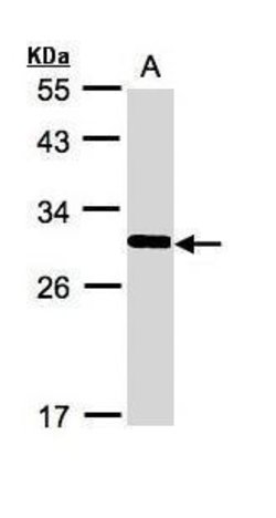 Invitrogen FRAT1 Polyclonal Antibody 100 &mu;L; Unconjugated:Antibodies,