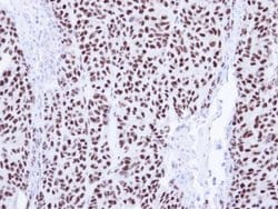 Invitrogen PIASy Polyclonal Antibody 100 &mu;L; Unconjugated:Antibodies,