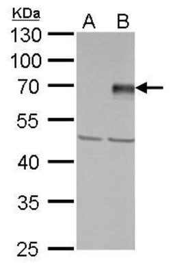 Invitrogen PIASy Polyclonal Antibody 100 &mu;L; Unconjugated:Antibodies,