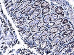 Invitrogen PIASy Polyclonal Antibody 100 &mu;L; Unconjugated:Antibodies,