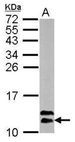 Invitrogen ROC1 Polyclonal Antibody 100 &mu;L; Unconjugated:Antibodies,