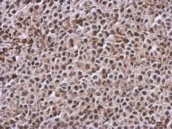 Invitrogen TIGAR Polyclonal Antibody 100 &mu;L; Unconjugated:Antibodies,