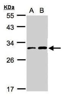 Invitrogen TIGAR Polyclonal Antibody 100 &mu;L; Unconjugated:Antibodies,