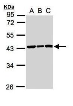 Invitrogen SMYD5 Polyclonal Antibody 100 &mu;L | Buy Online | Invitrogen&trade; | Fisher Scientific