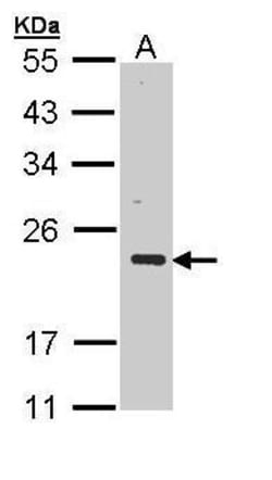 Invitrogen CSRP3 Polyclonal Antibody 100 &mu;L; Unconjugated:Antikroppar