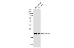 Invitrogen CSRP3 Polyclonal Antibody 100 &mu;L; Unconjugated:Antikroppar