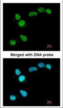 Invitrogen APE1 Polyclonal Antibody 100 &mu;L | Buy Online | Invitrogen&trade; | Fisher Scientific