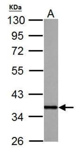 Invitrogen APE1 Polyclonal Antibody 100 &mu;L | Buy Online | Invitrogen&trade; | Fisher Scientific