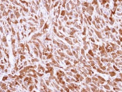 Invitrogen BID Polyclonal Antibody 100 &mu;L; Unconjugated:Antibodies,