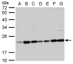 Invitrogen BID Polyclonal Antibody 100 &mu;L; Unconjugated:Antibodies,