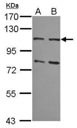 Invitrogen MSH2 Polyclonal Antibody 100 μL; Unconjugated:Antibodies,