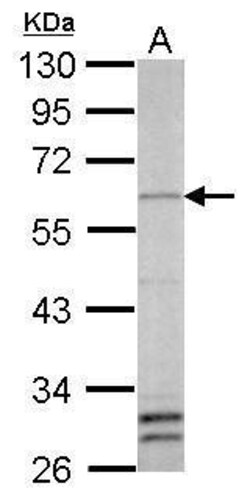 Invitrogen YY1 Polyclonal Antibody 100 &mu;L; Unconjugated:Anticuerpos