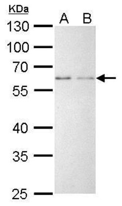 Invitrogen YY1 Polyclonal Antibody 100 &mu;L; Unconjugated:Anticuerpos