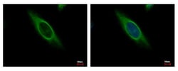 Invitrogen CAB39 Polyclonal Antibody 100 &mu;L; Unconjugated:Antibodies,