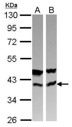 Invitrogen CAB39 Polyclonal Antibody 100 &mu;L; Unconjugated:Antibodies,