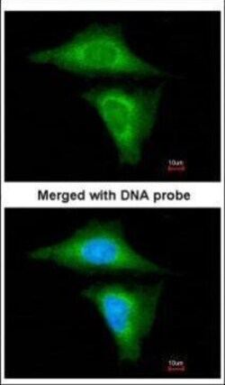 Invitrogen RBP4 Polyclonal Antibody 100 μL; Unconjugated:Antibodies,