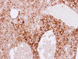 Invitrogen RBP4 Polyclonal Antibody 100 μL; Unconjugated:Antibodies,