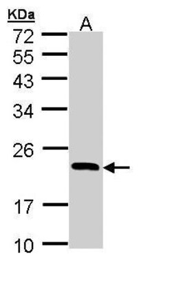 Invitrogen RBP4 Polyclonal Antibody 100 μL; Unconjugated:Antibodies,