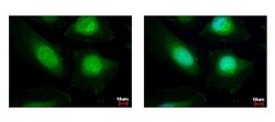Invitrogen HAT1 Polyclonal Antibody 100 &mu;L; Unconjugated:Antibodies,