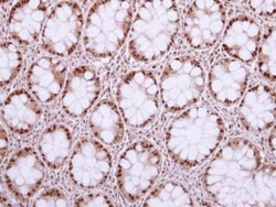 Invitrogen HAT1 Polyclonal Antibody 100 &mu;L; Unconjugated:Antibodies,