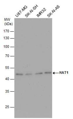Invitrogen HAT1 Polyclonal Antibody 100 &mu;L; Unconjugated:Antibodies,