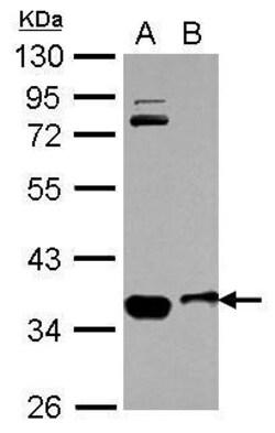 Invitrogen OSTM1 Polyclonal Antibody 100 &mu;L | Buy Online | Invitrogen&trade; | Fisher Scientific