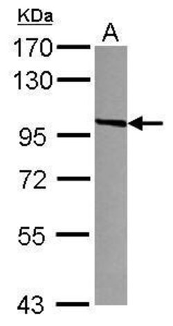 Invitrogen VCAM-1 Polyclonal Antibody 100 &mu;L | Buy Online | Invitrogen&trade; | Fisher Scientific