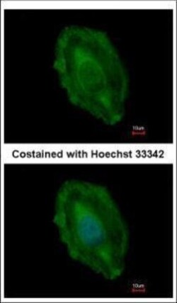 Invitrogen Aspartoacylase Polyclonal Antibody 100 &mu;L; Unconjugated:Antibodies,
