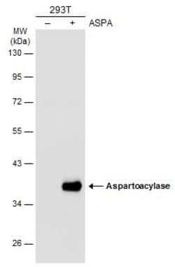Invitrogen Aspartoacylase Polyclonal Antibody 100 &mu;L; Unconjugated:Antibodies,