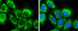 Invitrogen SLC25A22 Polyclonal Antibody 100 &mu;L; Unconjugated:Antibodies,