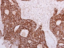 Invitrogen SLC25A22 Polyclonal Antibody 100 &mu;L; Unconjugated:Antibodies,