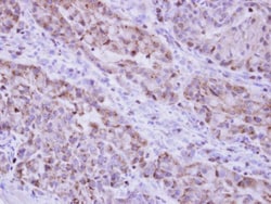 Invitrogen Catalase Polyclonal Antibody 100 &mu;L; Unconjugated:Antibodies,