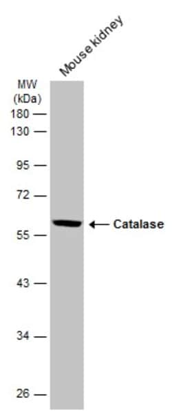 Invitrogen Catalase Polyclonal Antibody 100 &mu;L; Unconjugated:Antibodies,