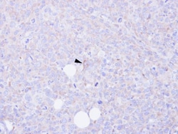 Invitrogen CARD9 Polyclonal Antibody 100 &mu;L; Unconjugated:Antibodies,
