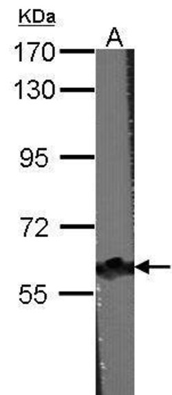 Invitrogen CARD9 Polyclonal Antibody 100 &mu;L; Unconjugated:Antibodies,