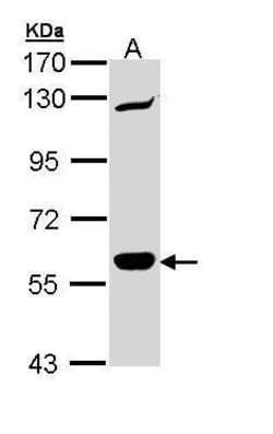 Invitrogen CARD9 Polyclonal Antibody 100 &mu;L; Unconjugated:Antibodies,