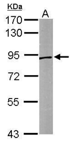 Invitrogen Sortilin Polyclonal Antibody 100 &mu;L | Buy Online | Invitrogen&trade; | Fisher Scientific