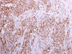 Invitrogen Sortilin Polyclonal Antibody 100 &mu;L | Buy Online | Invitrogen&trade; | Fisher Scientific