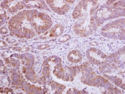 Invitrogen Gemin 3 Polyclonal Antibody 100 μL; Unconjugated:Antibodies,