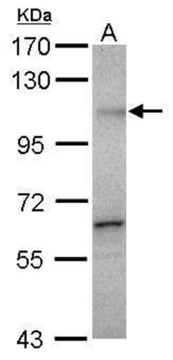 Invitrogen Gemin 3 Polyclonal Antibody 100 μL; Unconjugated:Antibodies,