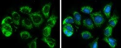 Invitrogen SLC25A6 Polyclonal Antibody 100 &mu;L; Unconjugated:Antibodies,