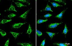 Invitrogen SLC25A6 Polyclonal Antibody 100 &mu;L; Unconjugated:Antibodies,