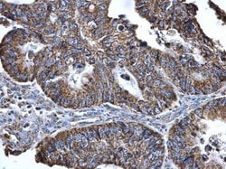 Invitrogen SLC25A6 Polyclonal Antibody 100 &mu;L; Unconjugated:Antibodies,