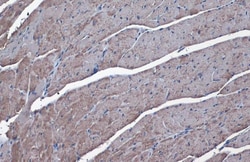 Invitrogen SLC25A6 Polyclonal Antibody 100 &mu;L; Unconjugated:Antibodies,