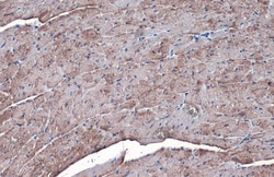 Invitrogen SLC25A6 Polyclonal Antibody 100 &mu;L; Unconjugated:Antibodies,