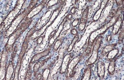Invitrogen SLC25A6 Polyclonal Antibody 100 &mu;L; Unconjugated:Antibodies,